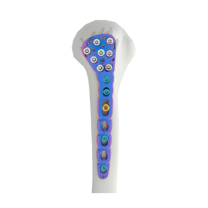 VAL Proximal Humeral Locking Plate